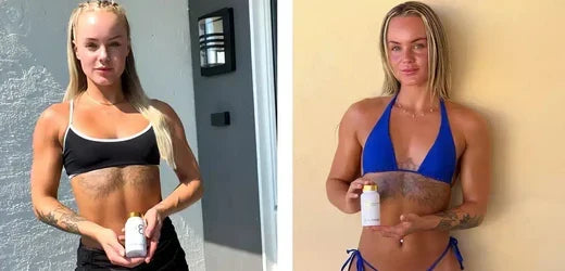 The Ultimate Guide to Tanning Capsules: Impressive Before-and-After Comparisons